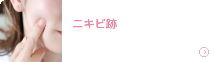 ニキビ跡