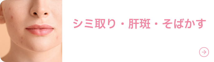 シミ取り・肝斑・そばかす