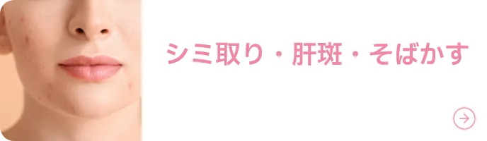 シミ取り・肝斑・そばかす