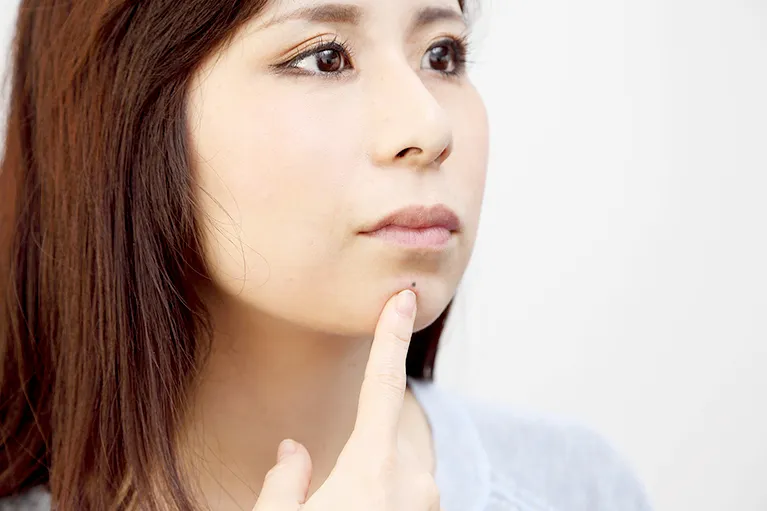 皮膚腫瘍外来とは